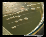 mycobacterium chelonae